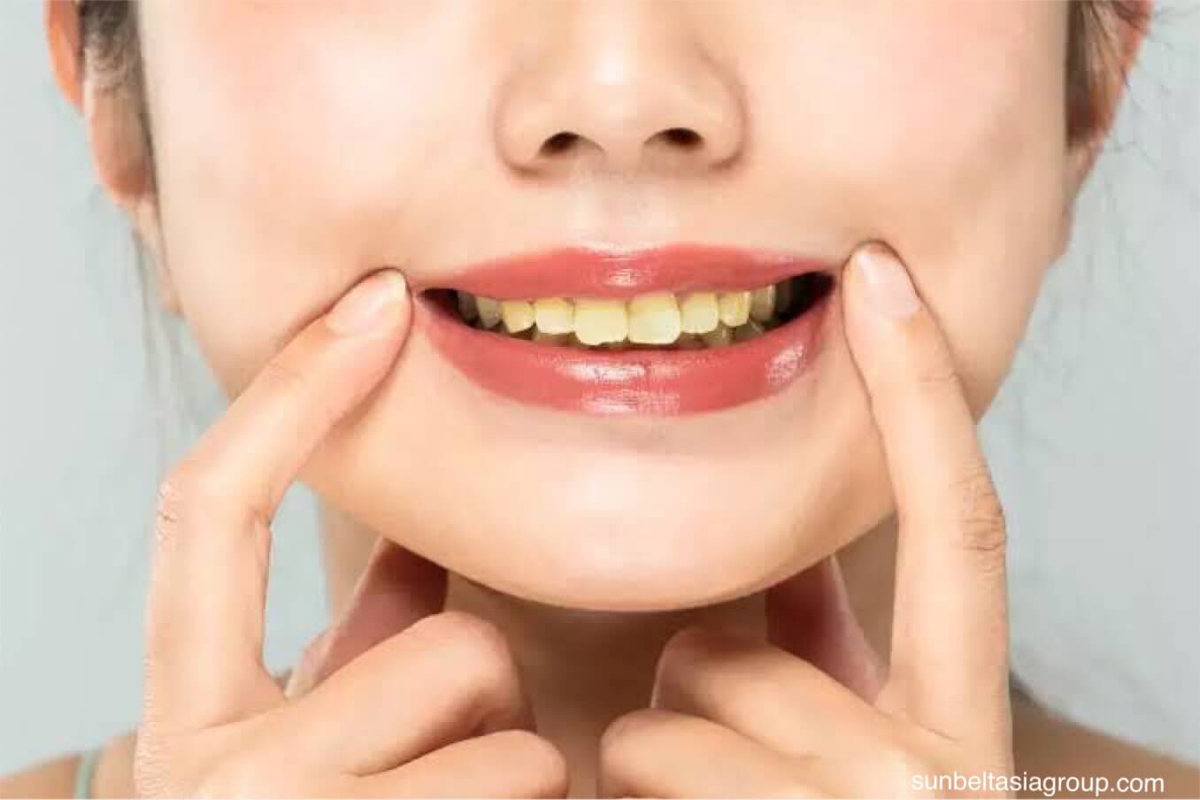 สาเหตุของฟันเหลือง สุขอนามัยที่ดี