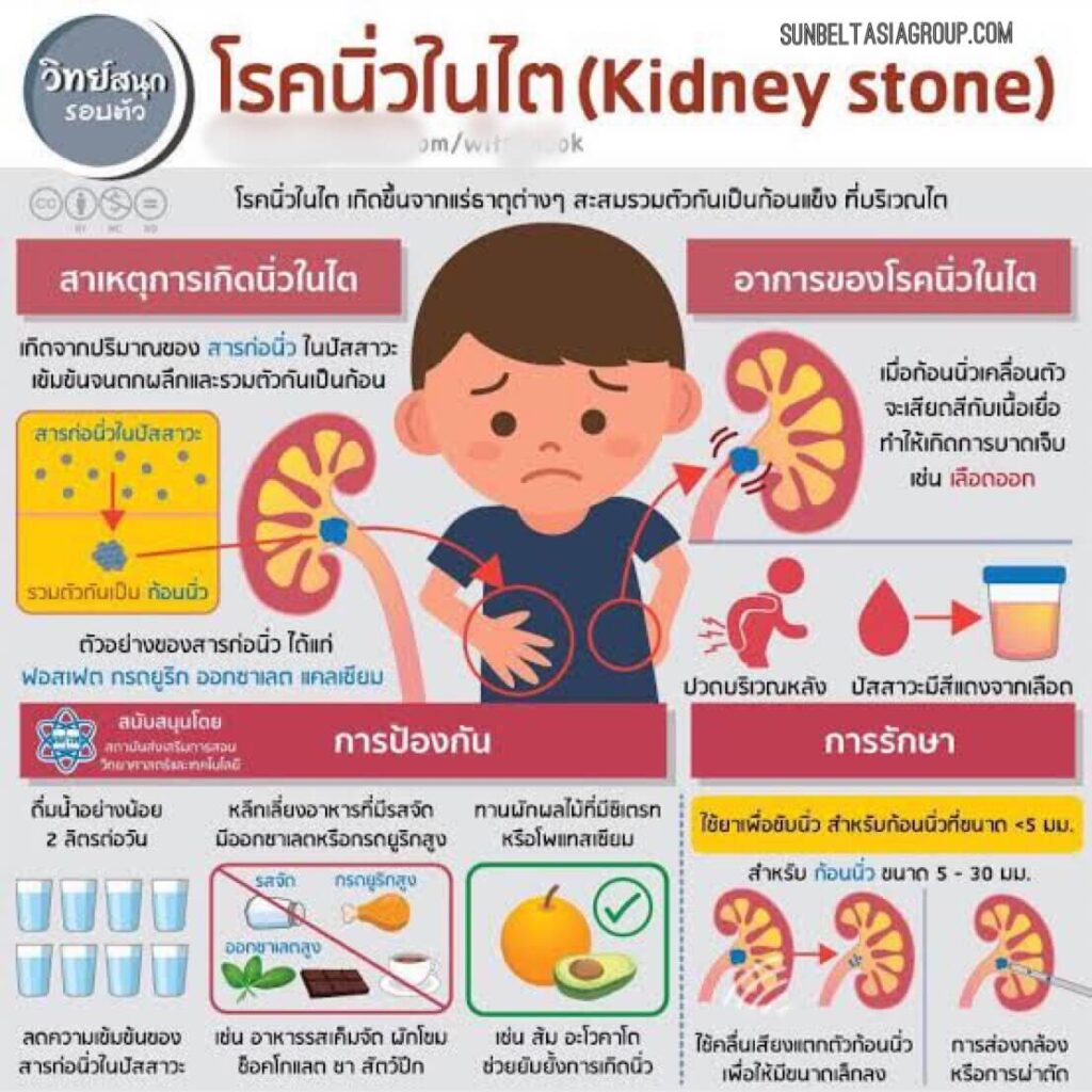 อาหารสำหรับนิ่วในไต คุณอาจต้องทำตามแผนการควบคุมอาหารพิเศษ ขั้นแรก แพทย์จะทำการตรวจเลือดและปัสสาวะเพื่อหาปัจจัยเสี่ยง