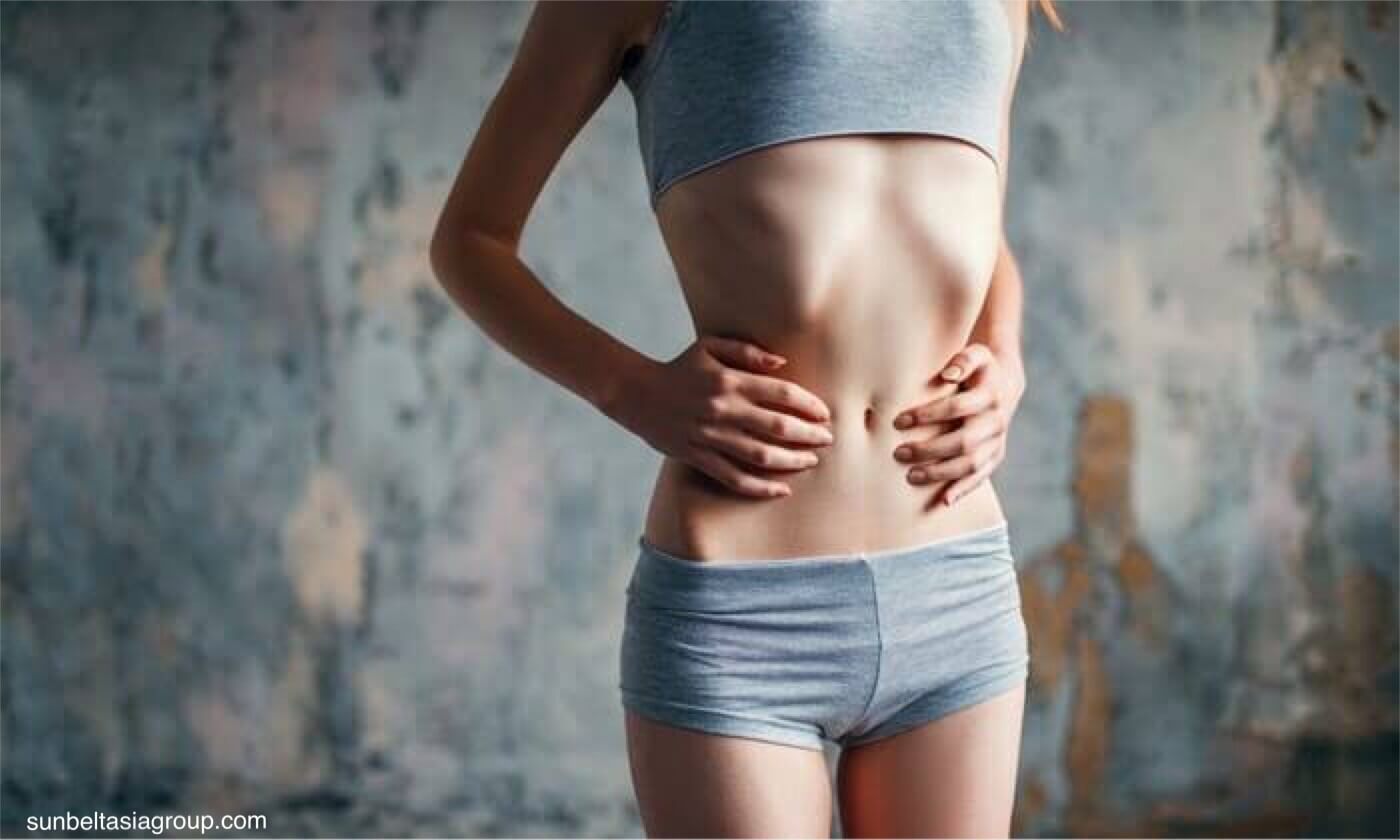 Anorexia nervosa โรคคลั่งผอม