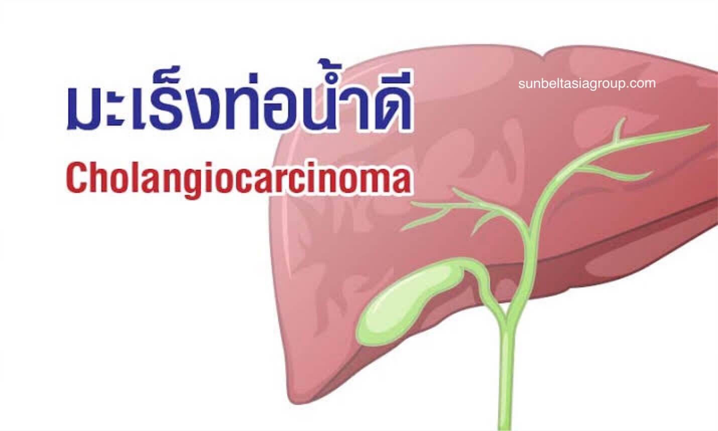 มะเร็งท่อน้ำดี ที่ควรรู้