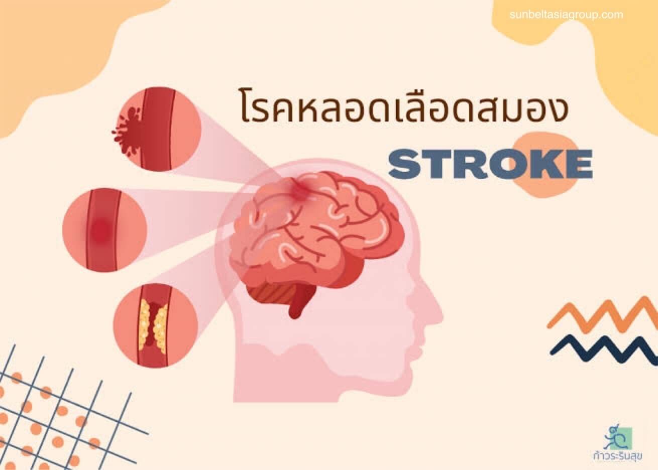 โรคหลอดเลือดสมอง เหตุฉุกเฉินทางการแพทย์ที่ควรรู้